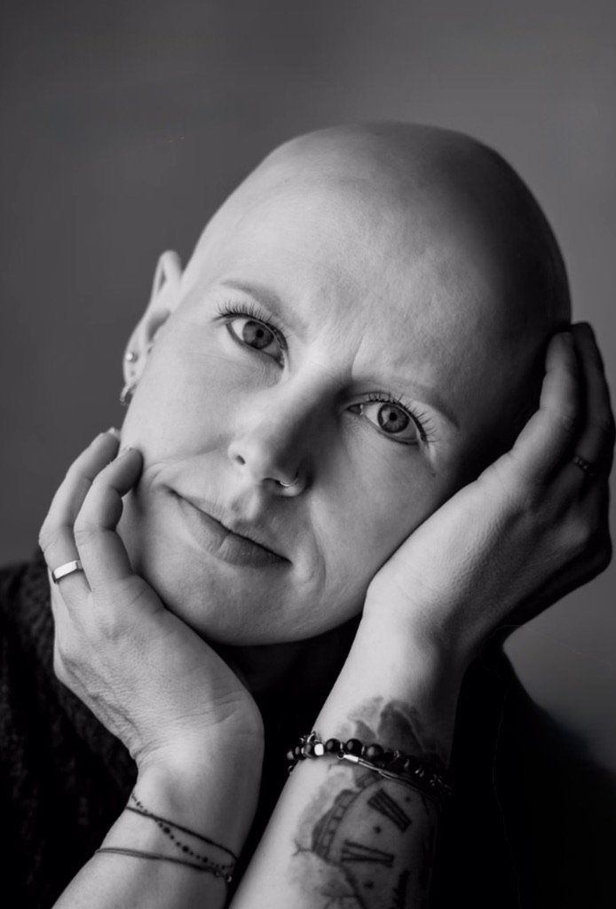 Client living with alopecia before her HEADS wig, black and white portrait