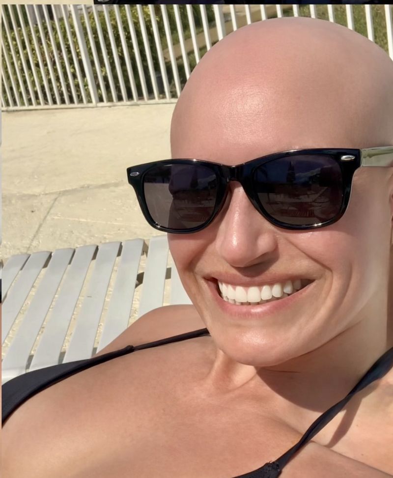 HEADS client enjoying the pool, confident without her wig