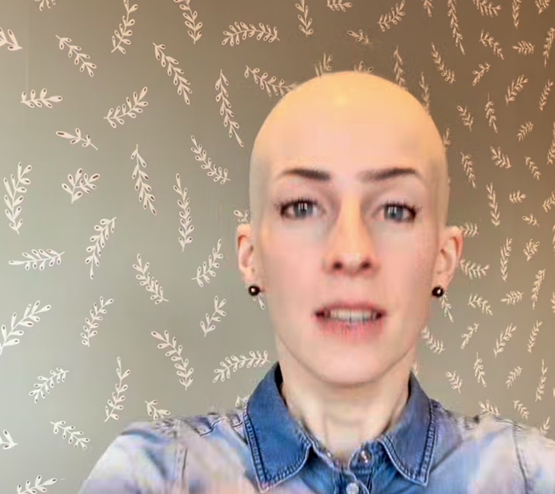HEADS Brand Ambassador with alopecia before putting on her wig