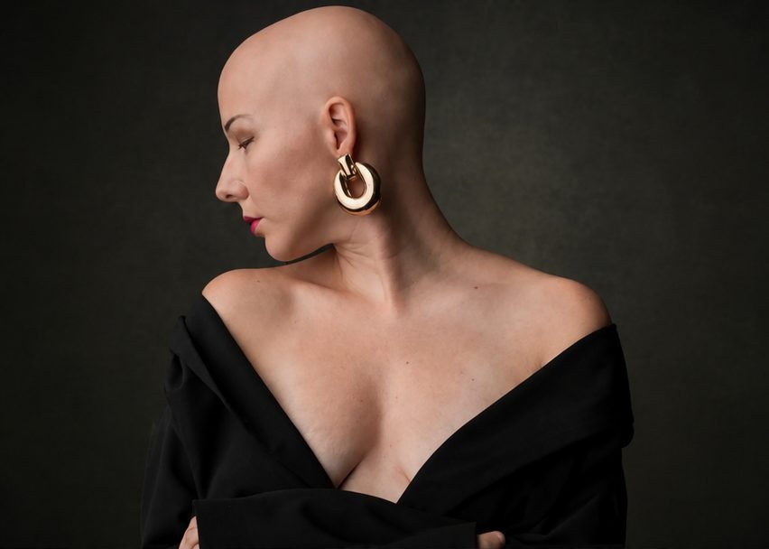 Portrait of a woman with alopecia, elegant and confident without a wig